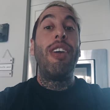 Chris Sky, Covid vaccine and HIV Connection. Surprise. HIV cases are Exploding around the World.