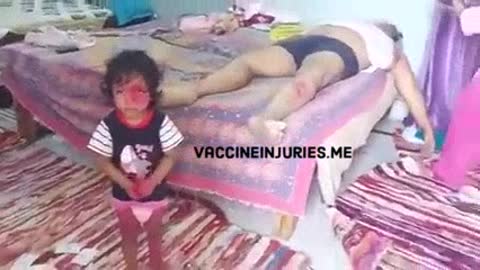 תופעת לוואי מוות תאומים נמצאו משחקים עם גופת אביהם שמת בפתאומיות