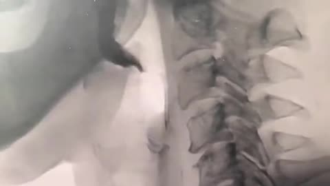 Informative video