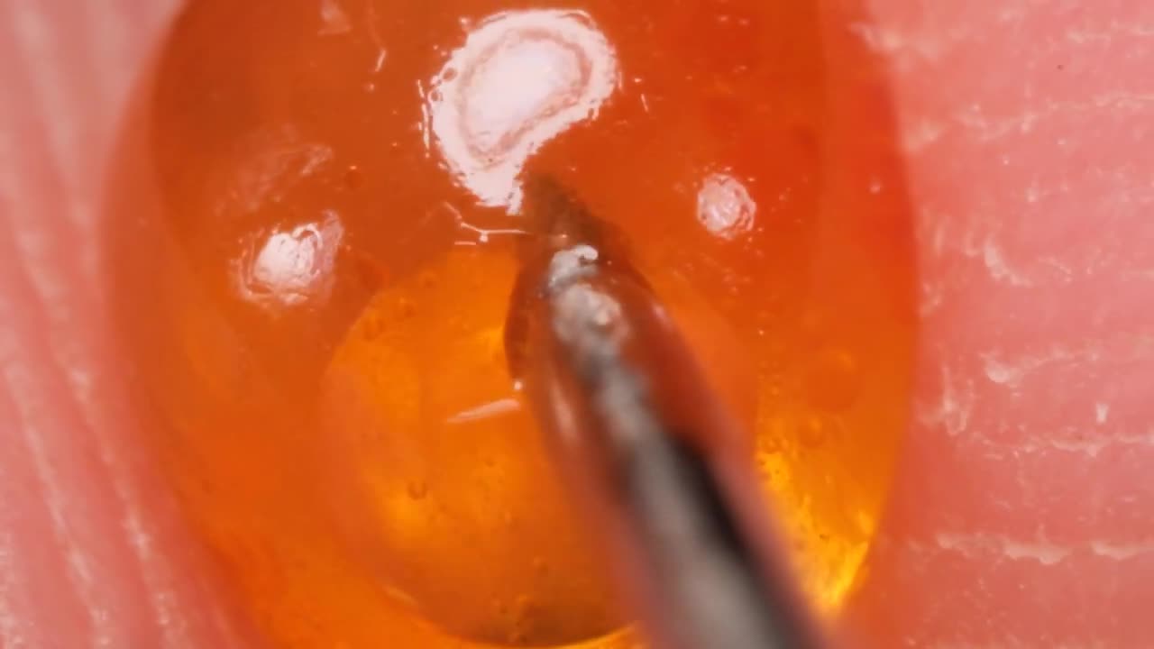 Caviar Macro Art - Piercing Caviar With a Needle👌