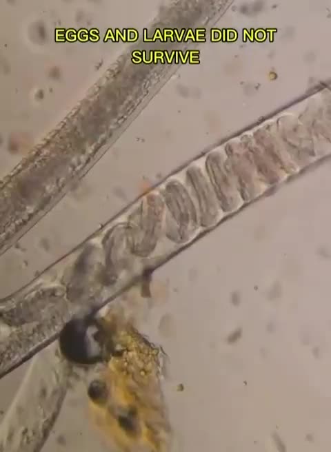 Cayenne Pepper kills human parasites