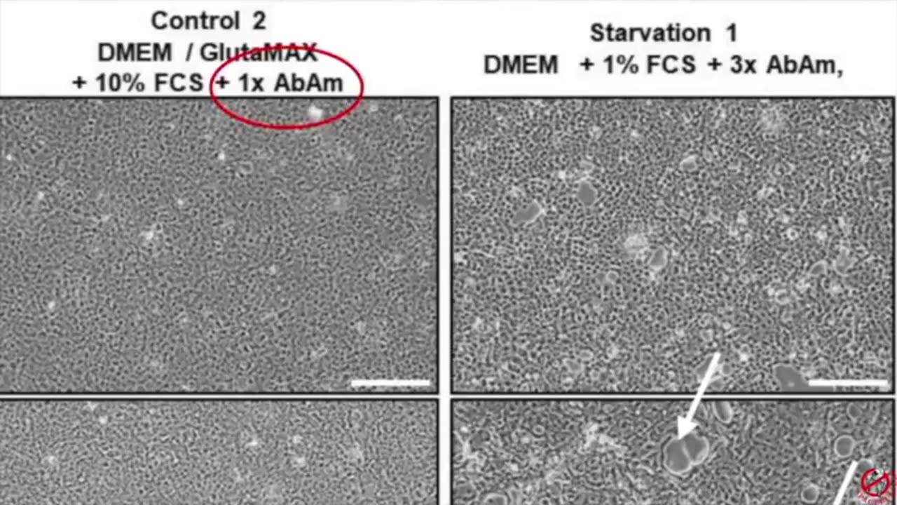 The End Of Germ Theory