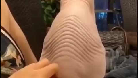 What it looks like when a cat flexes its back skin