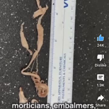 Pathologists silenced and unable to talk about the Clots from the Clotshots