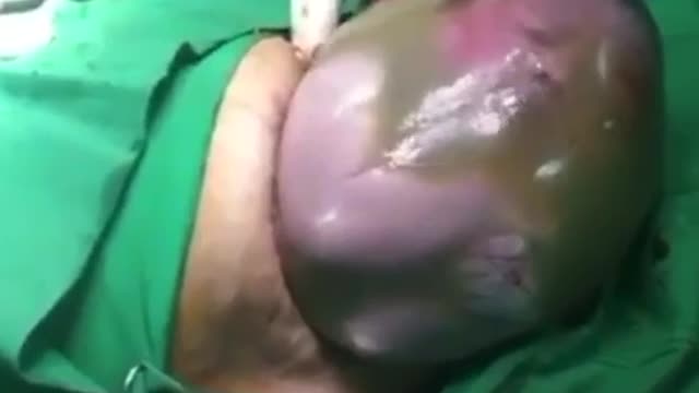 Surgery that will make you cry and smile.