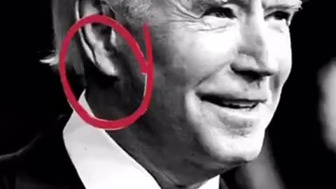 Biden instant healing ear plastic surgery