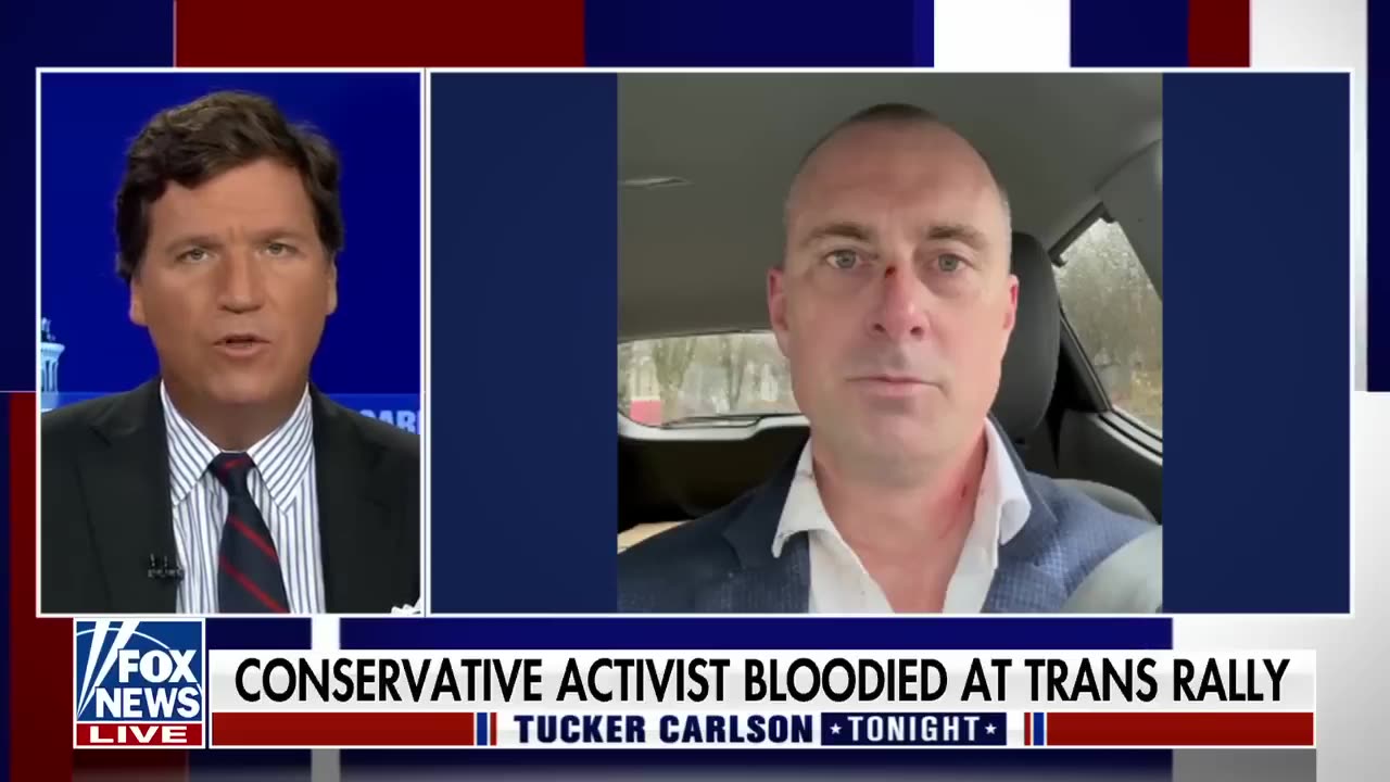 Tucker Carlson eviscerates Dems for exploiting ‘suffering’ people