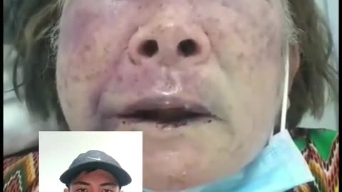 Mujer de 73 años se le metieron a su casa para robare el celular