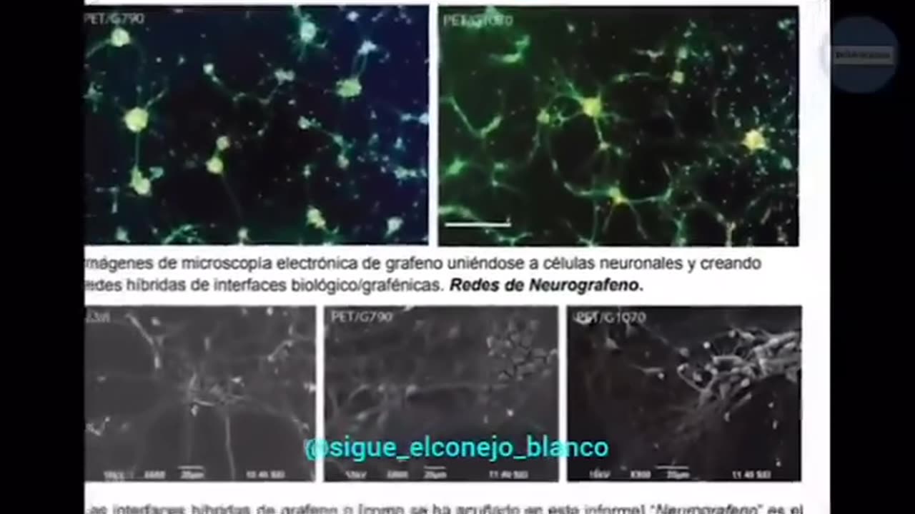 Consecuencias de las vacunas con grafeno