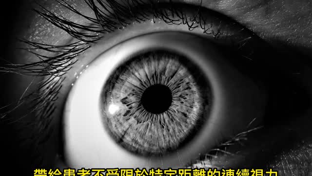 白內障術後視力一定好？ 有散光應確實矯正