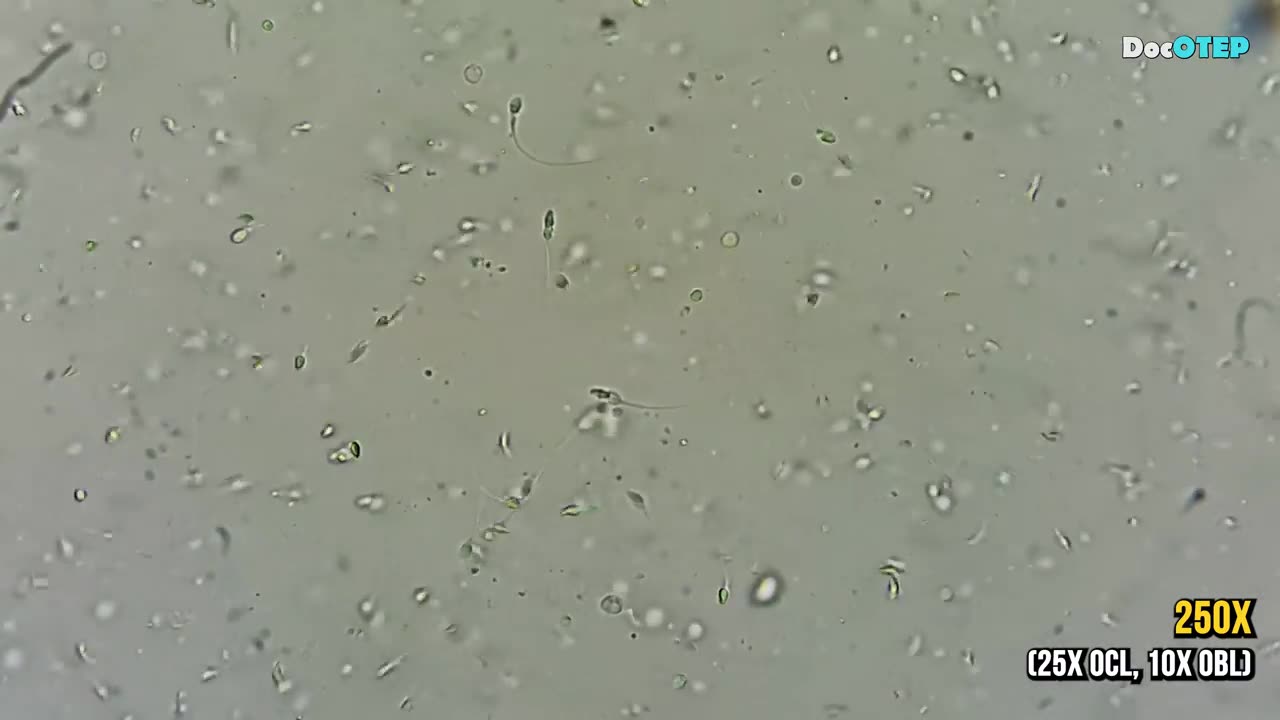 46. Human Live Sperm (Microscope 100x-2500x)