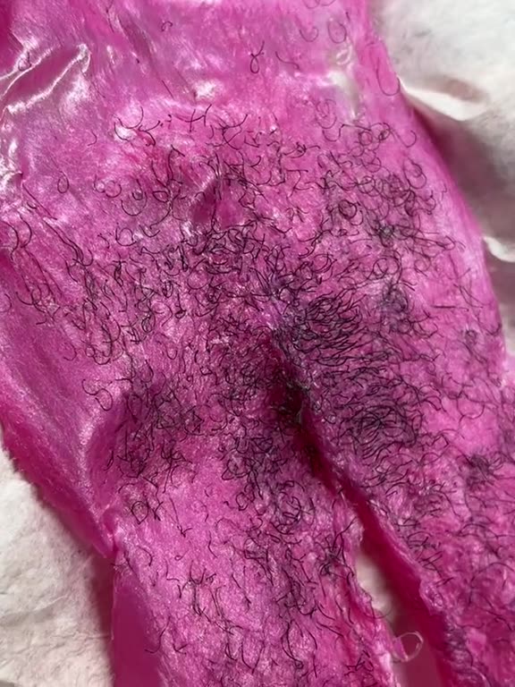 Bikini Wax Results with Sexy Smooth Tickled Pink Premium Synthetic Hard Wax! by Keaux Esthetics