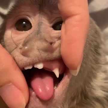 Money losts his teeth