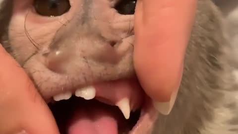 Money losts his teeth