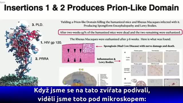 Covid Vaccine contains HIV spike protein and mad cow disease by Dr Richard Fleming