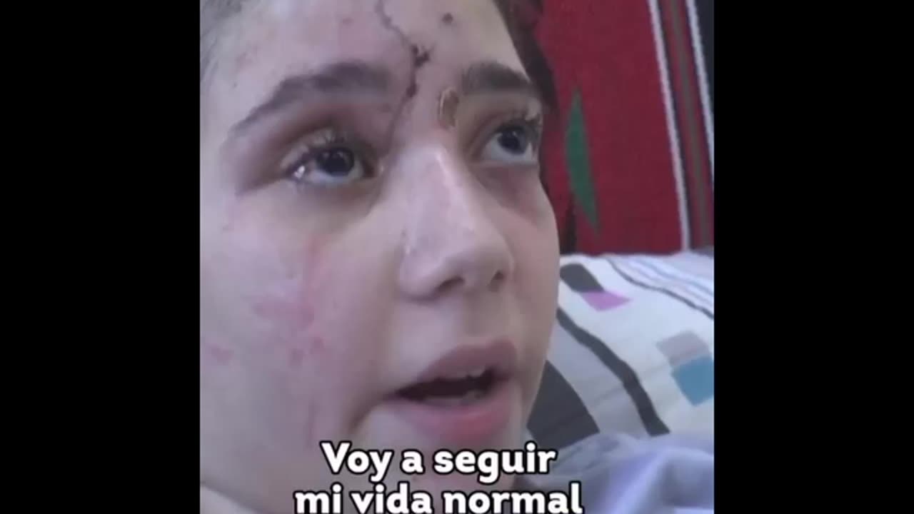 Utilizzano armi che non avevamo mai visto prima.