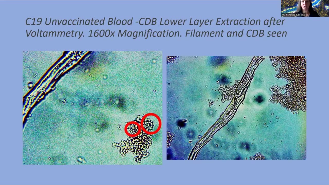 Evidence of Crimes Against Humanity Dr. Ana Mihalcea, PhD - Darkfield Analysis