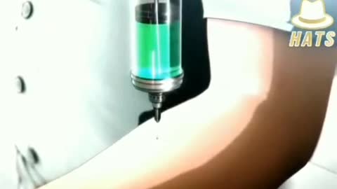 They Have to tell us What they are doing