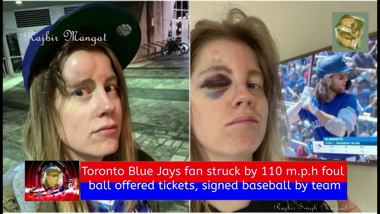 Toronto Blue Jays fan struck by 110 m.p.h foul ball offered tickets, signed baseball by team