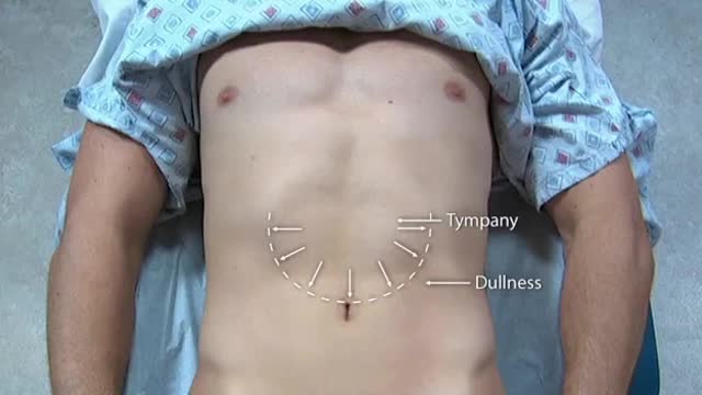 Special Techniques Abdomen