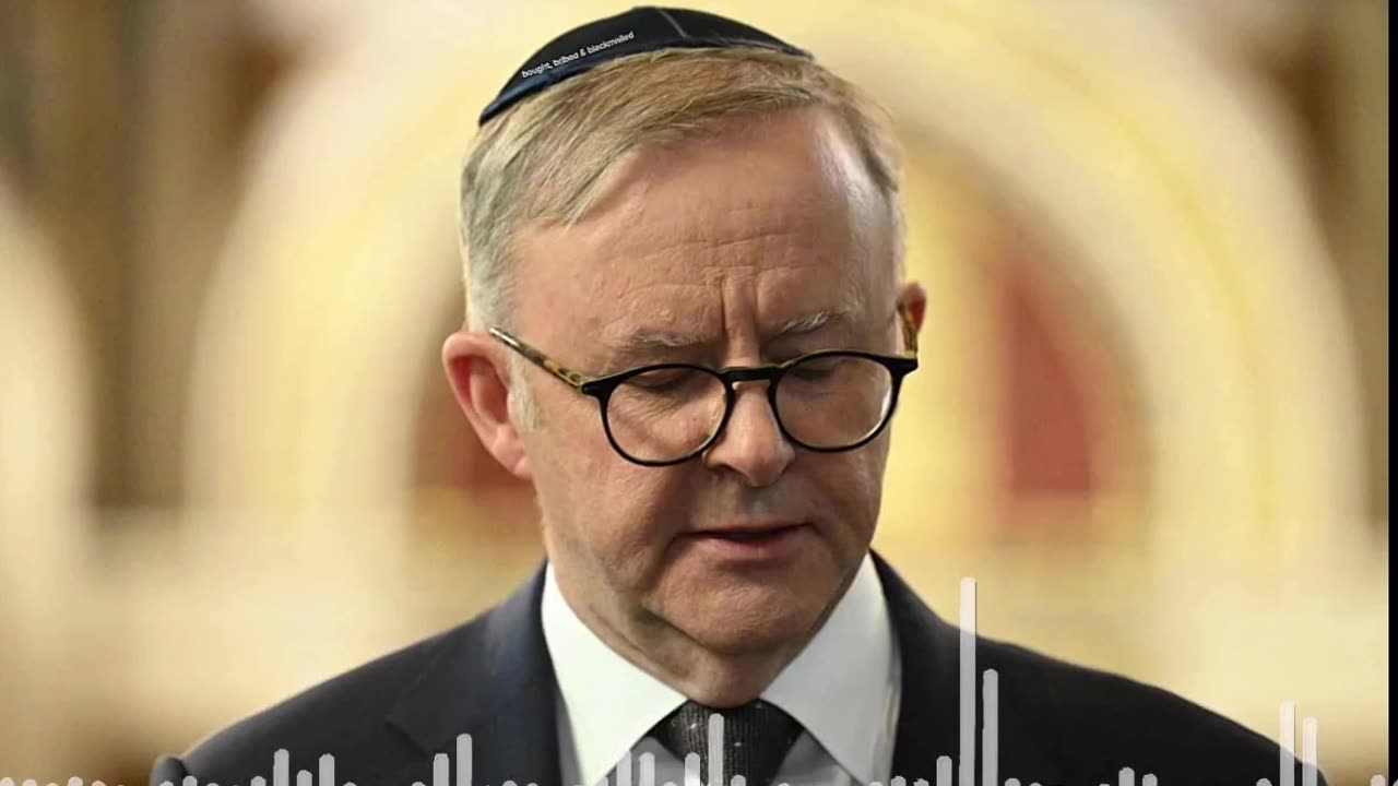 Australia is owned, just like in America.