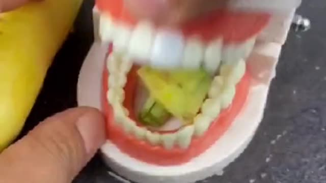 Funny Dental restoration