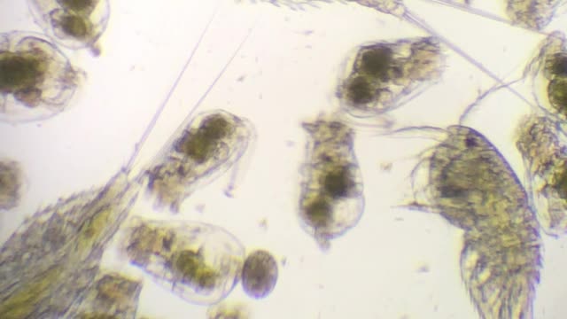 MIcoscopic Pictures of Ritifers and Copepods