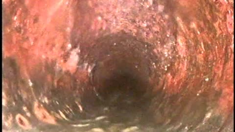 Lewis 42 Beaver Dam Road Sewer camera