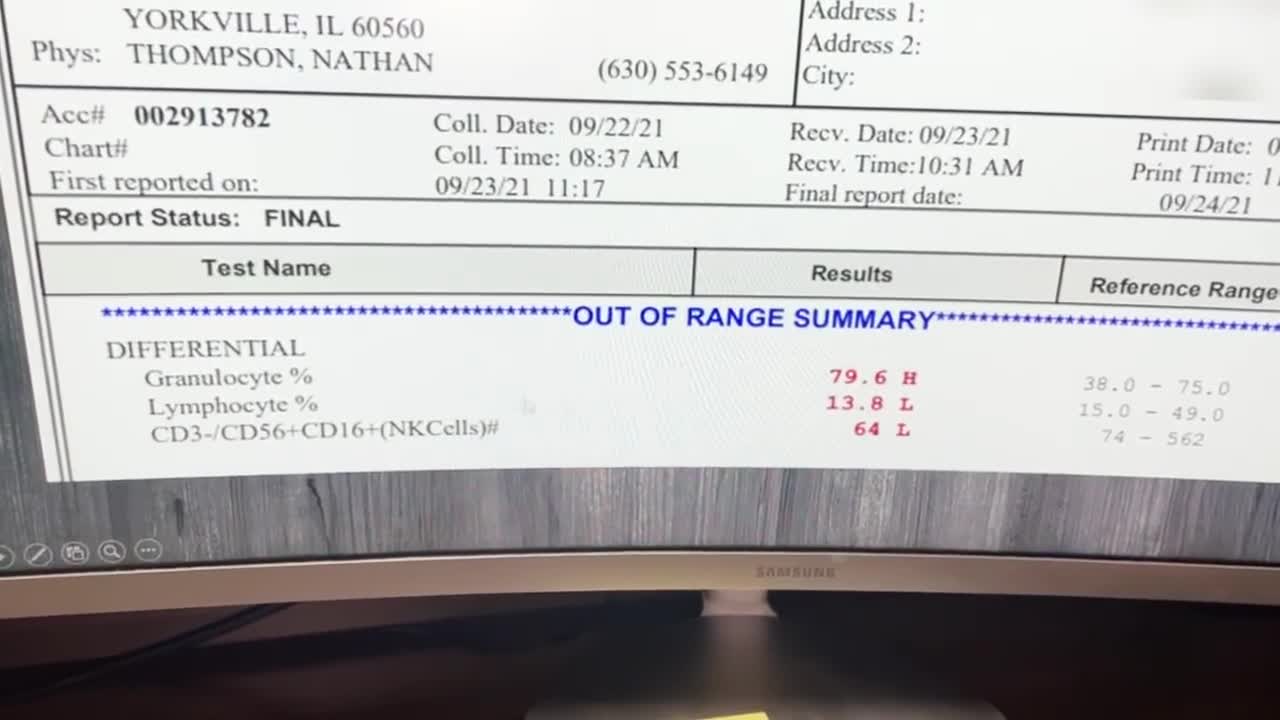 My Jaw DROPPED when I Tested Someone's Immune System After the 2nd Jab.