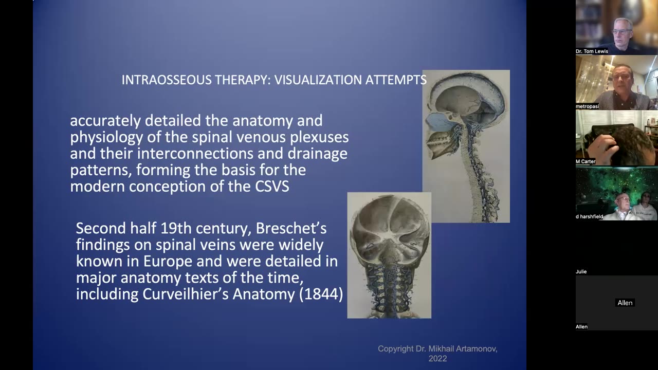 131. Novel Approach - Intraosseous Approach in Medicine Dr. Artamonov MD, PhD