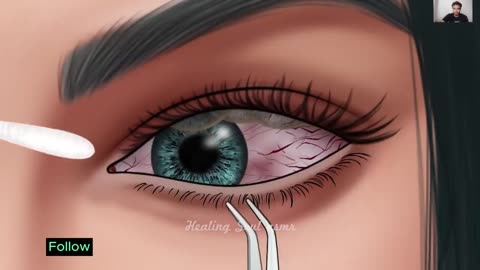 ASMR_Remove_6_layers_of_contact_lenses