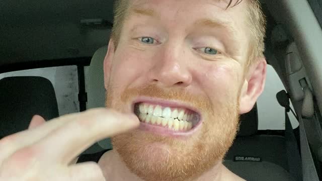 That time Sean Strickland broke my jaw