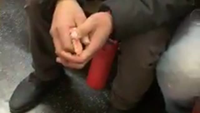 Man has dentures in hand