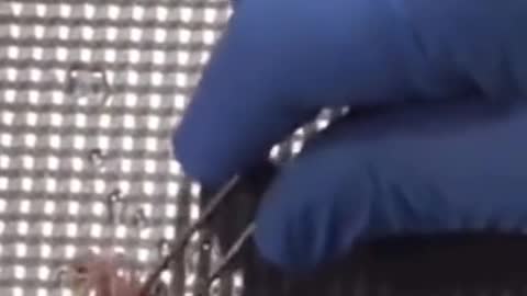 חלבונים דמויי קרישי דם נמצאו בתוך נפטרי החיסונים