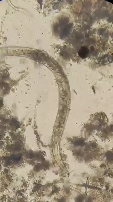 What Kind of Parasites are in this Hot Dog?