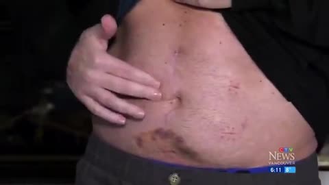 This Terrible Thing Happen After Vaccination