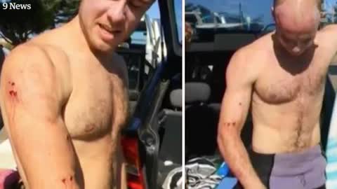 ‘I just punched it in the face’_ Surfer describes fending off shark