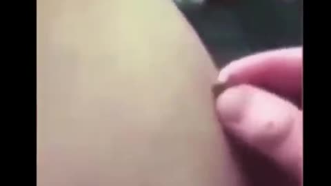 ΜΑΓΙΚΟ ΕΜΒΟΛΙΟ ΚΑΝΕΙ ΤΟ ΣΩΜΑ ΣΟΥ ΜΑΓΝΗΤΗ