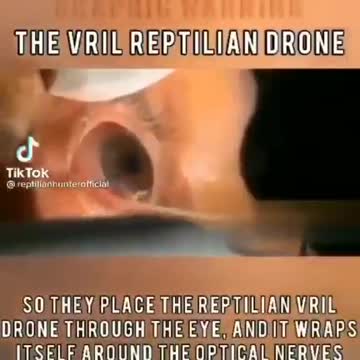 Vril can be removed but the host consciousness never returns...