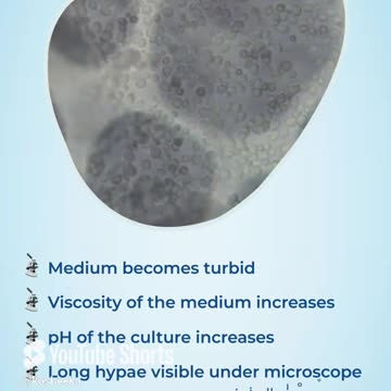 5 Sign of Yeast Contamination #yeastinfections #cellculture #kosheeka