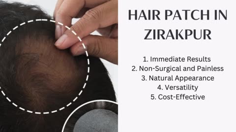 Hair Patch In Zirakpur