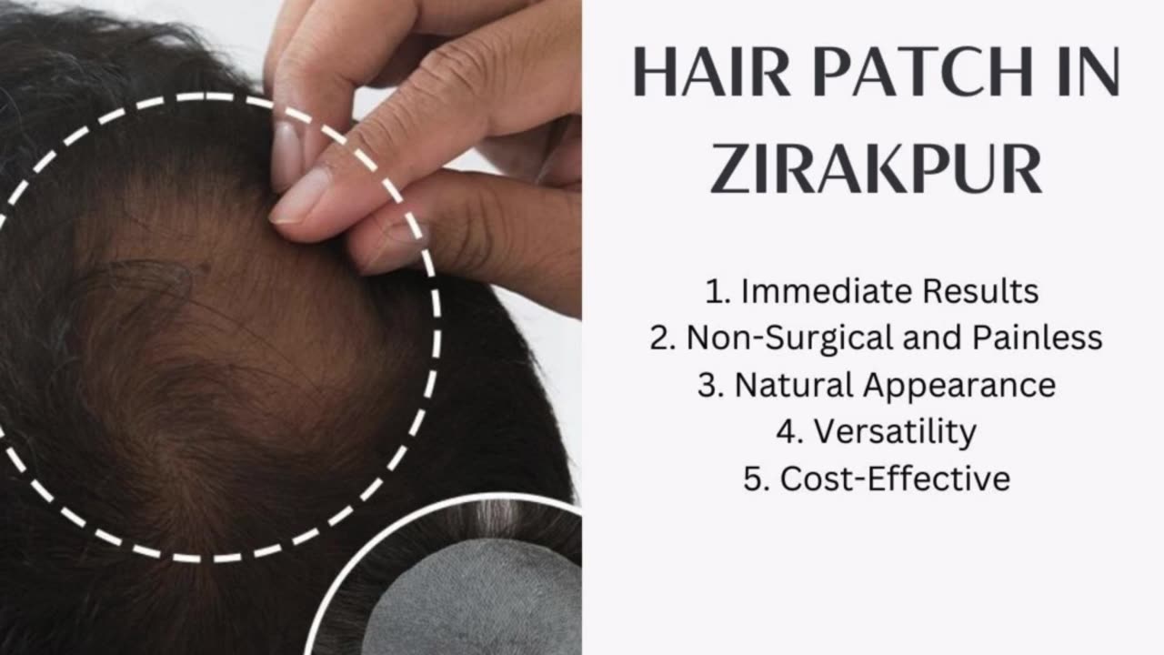 Hair Patch In Zirakpur