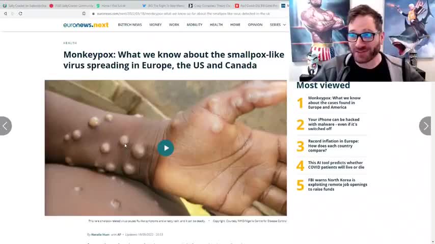 Everyone Knows That Bill Gates Is Behind The Monkeypox Outbreak