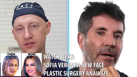 Simon Cowell NEW FACE | Plastic Surgery Analysis