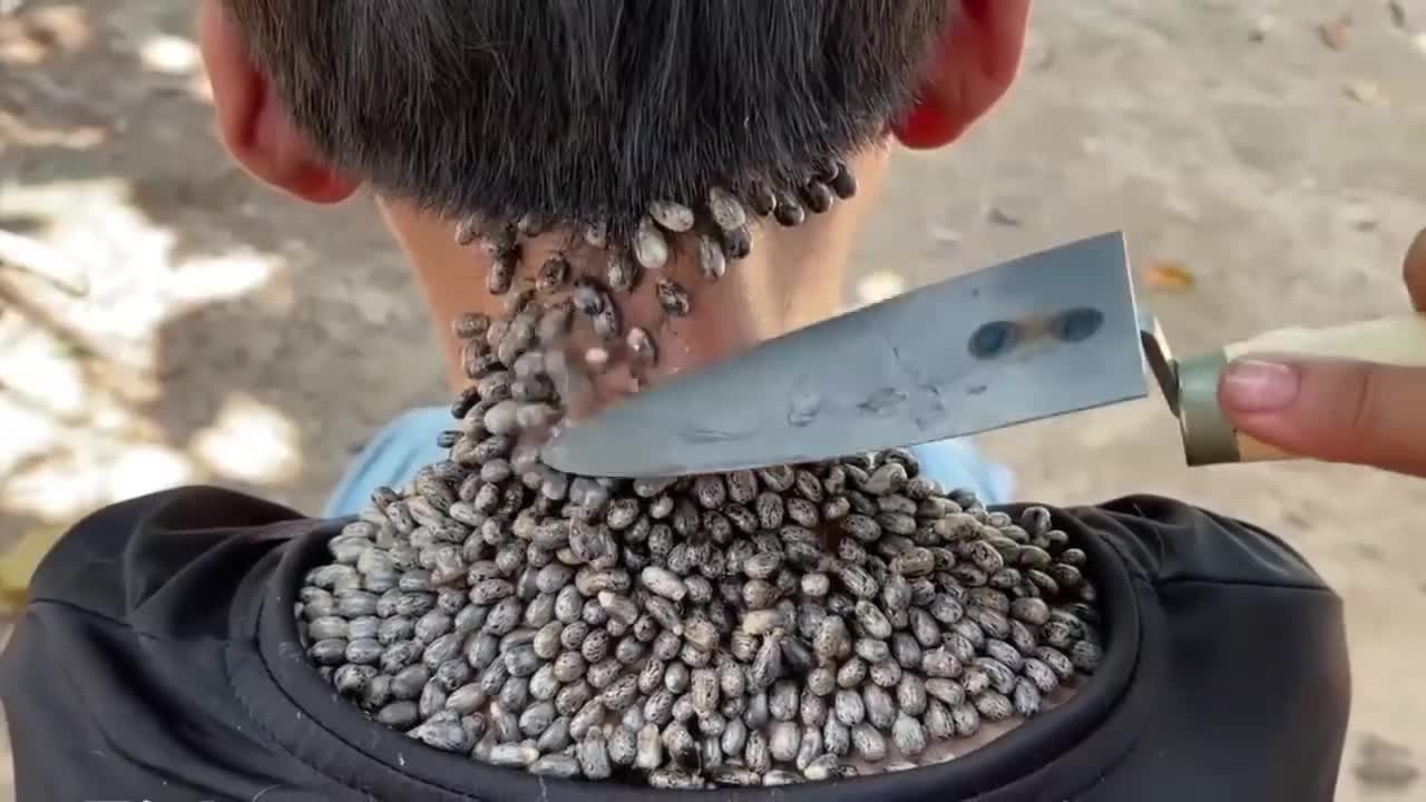 removing bugs from the body