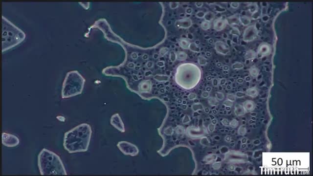 Microscopy analysis of a Pfizer-BioNTech Covid "vaccine" sample.