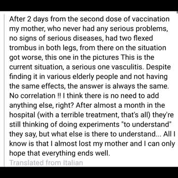 Second Dose 💉😵‍💫