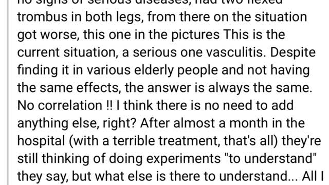 Second Dose 💉😵‍💫