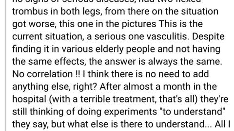 Second Dose 💉😵‍💫