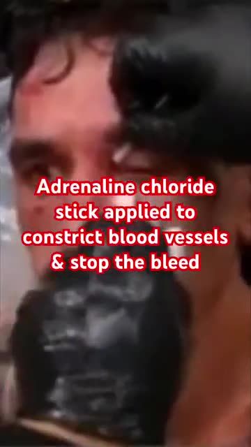 😱UFC Nasty Cuts: Holloway Yadong #short #pov